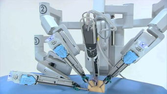 机器人制霸手术台 外企垄断格局下，国产普通机械制造的突围之路